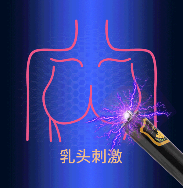 23470998703_279567083 — копия Електростимулятор ElectroFlash Intim Lux