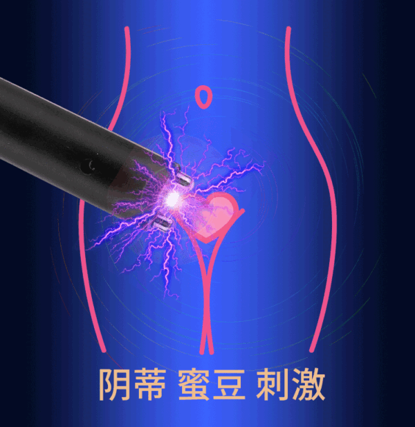 23557123759_279567083 — копия Електростимулятор ElectroFlash Intim Lux